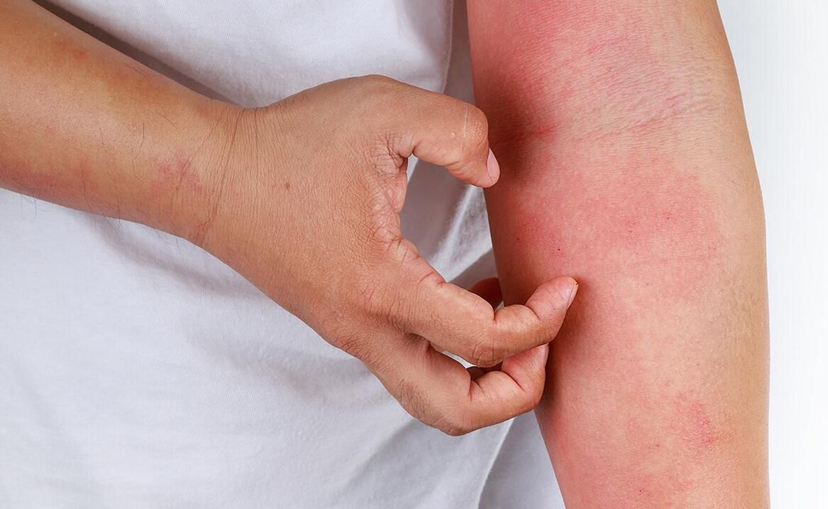 soda kullanımından kaynaklanan olası komplikasyonlar